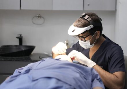 Hair Transplant