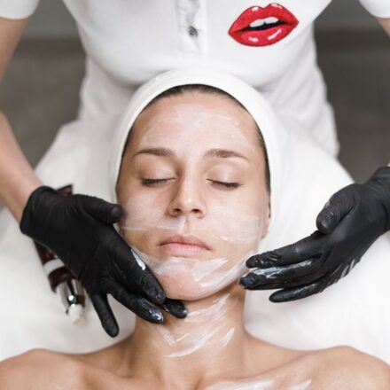 chemical peel treatment