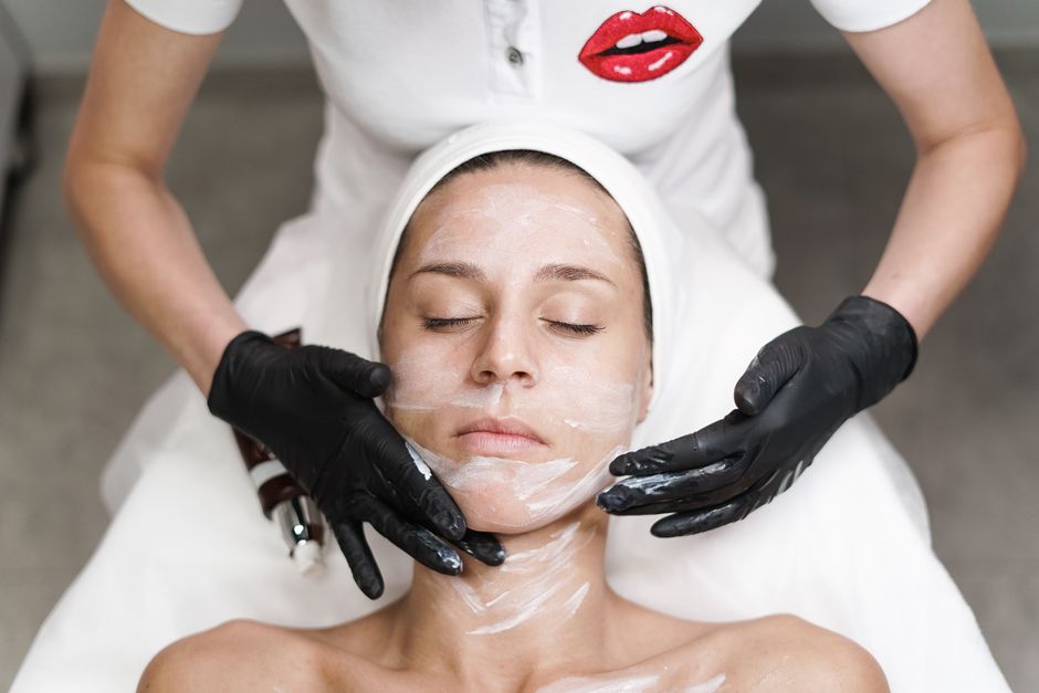 chemical peel treatment
