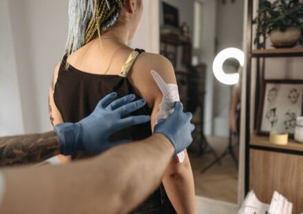 eliminación tatuaje láser