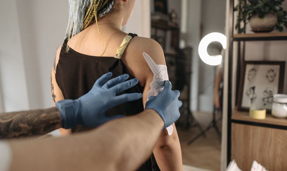 eliminación tatuaje láser
