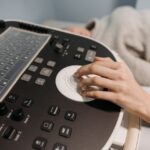 超音波診断装置 価格